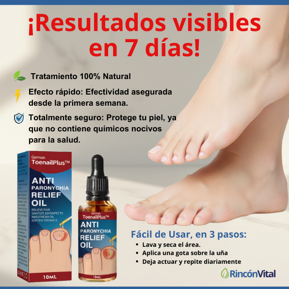 TRATAMIENTO NATURAL ANTIHONGOS - German ToenailPlus 2X1